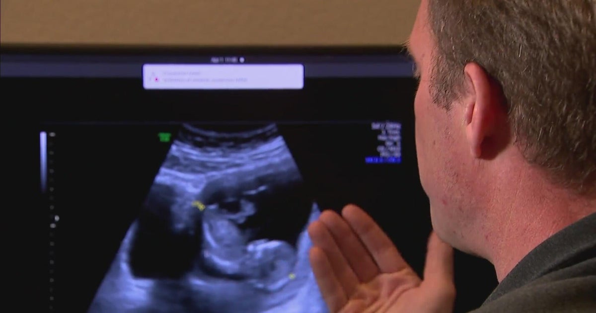 Colorado father's loss inspires AI technology that could change pregnancy care