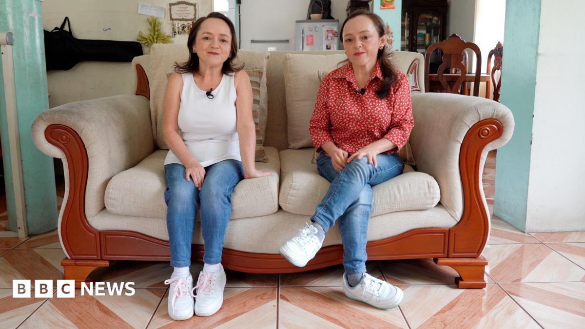 Could these twins’ rare genetic disorder provide the key to preventing cancer?